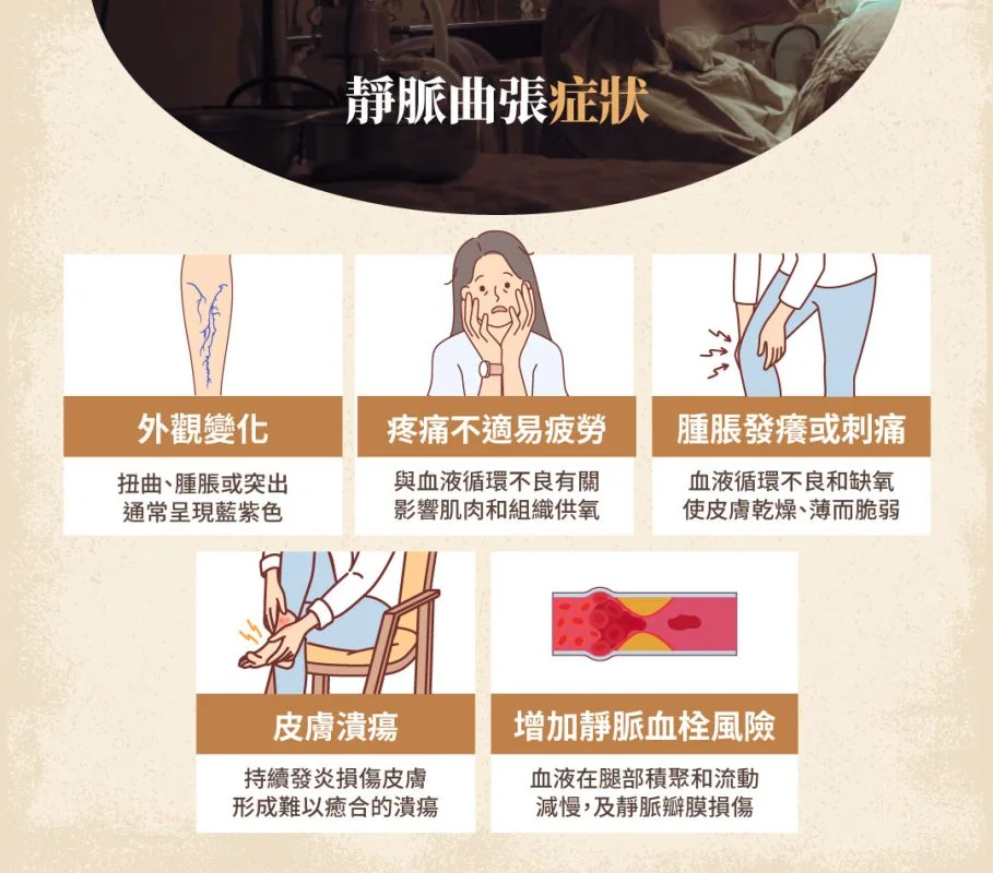 靜脈曲張  症狀