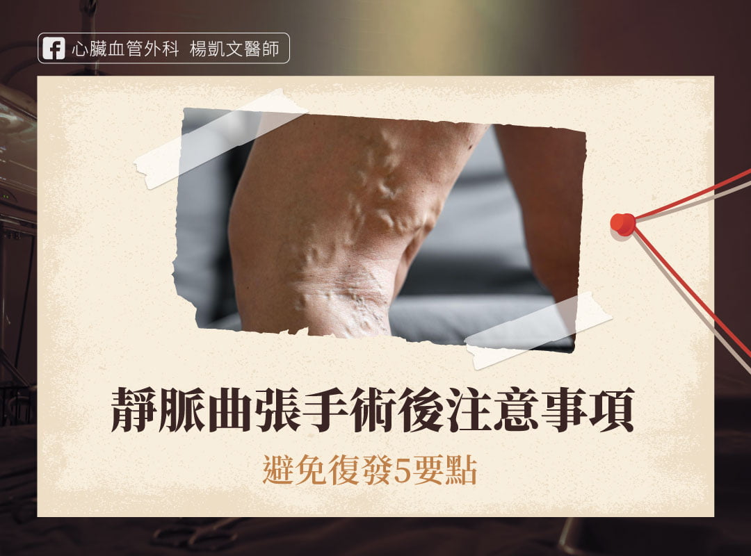 靜脈曲張手術 注意事項