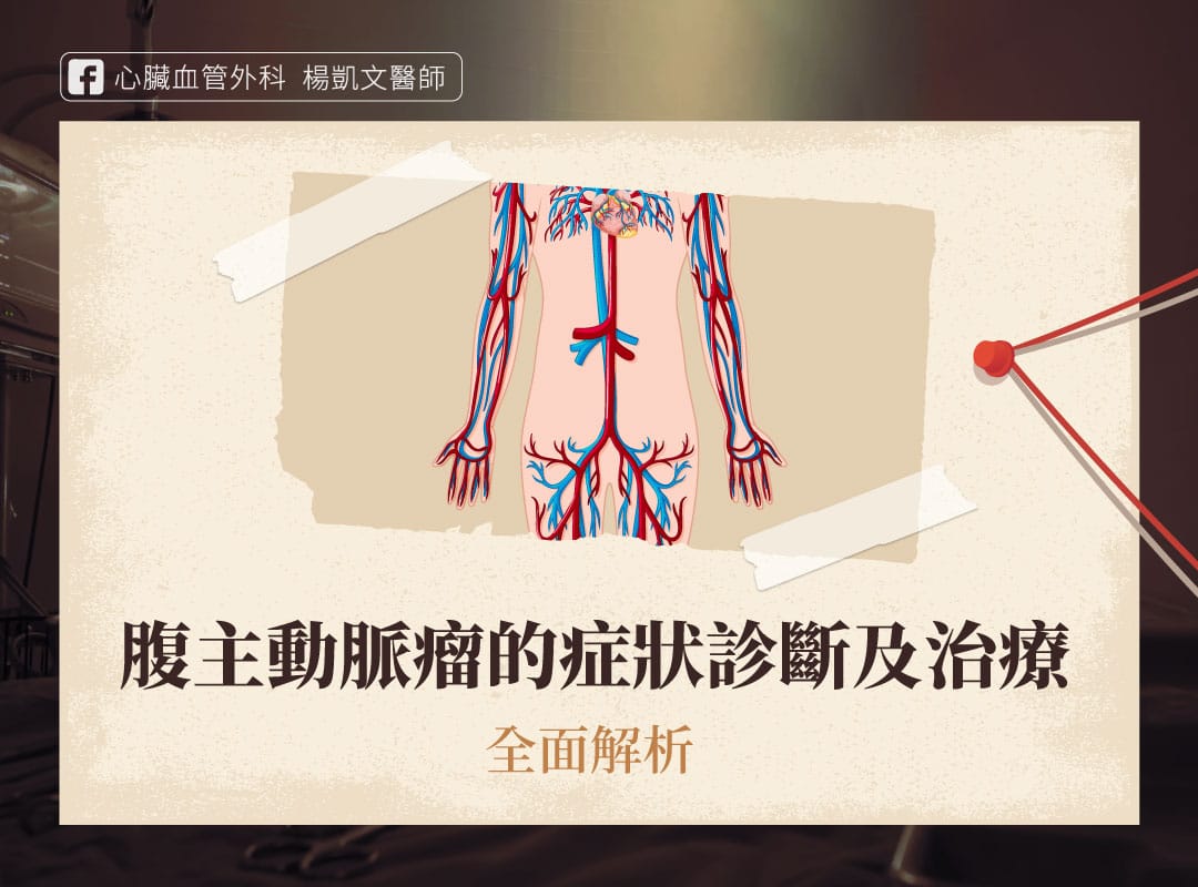 腹主動脈瘤症狀