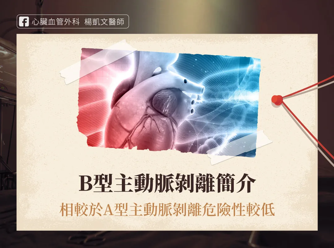 B型主動脈剝離