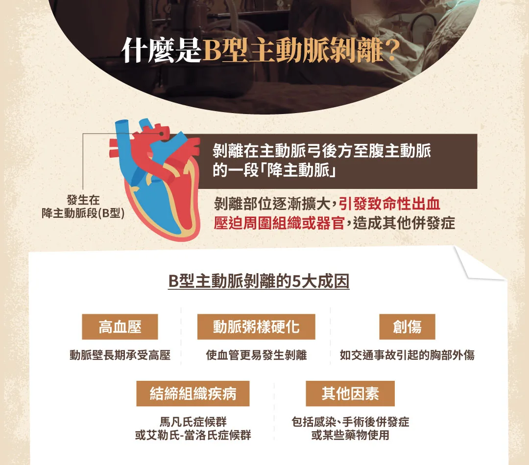 b型主動脈剝離 成因