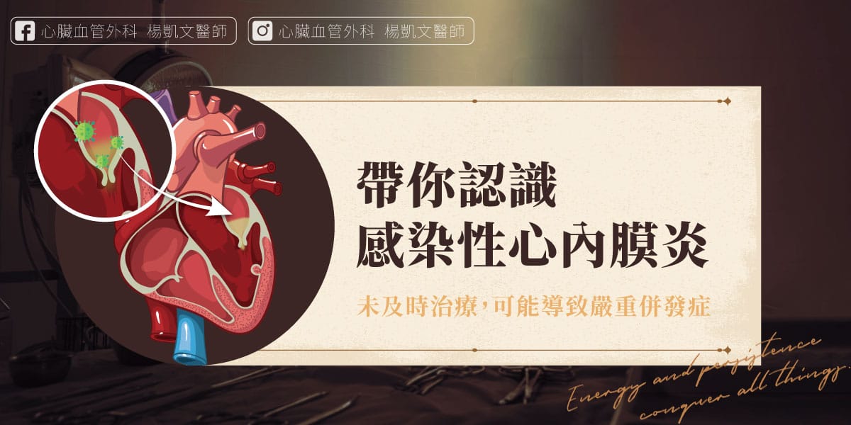 感染性心內膜炎
