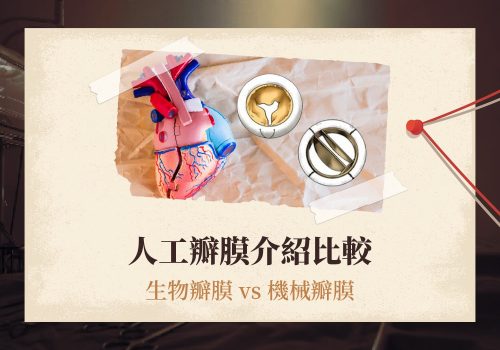 人工瓣膜介紹