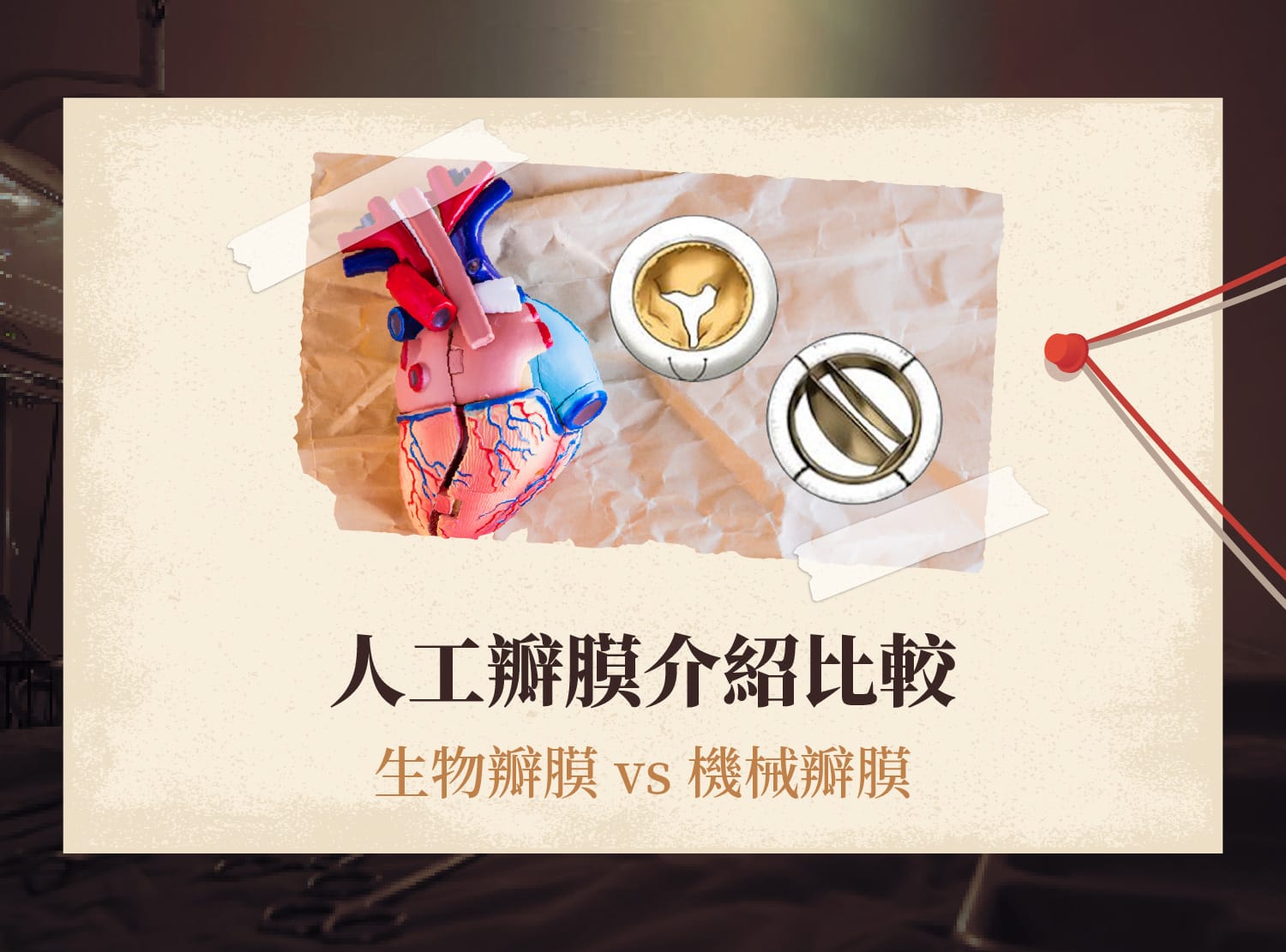 人工瓣膜介紹