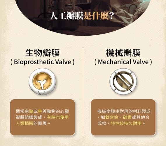 人工瓣膜