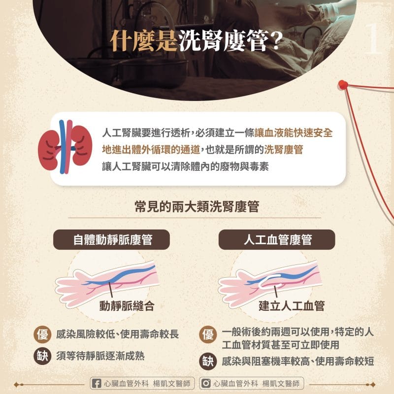 什麼是洗腎廔管