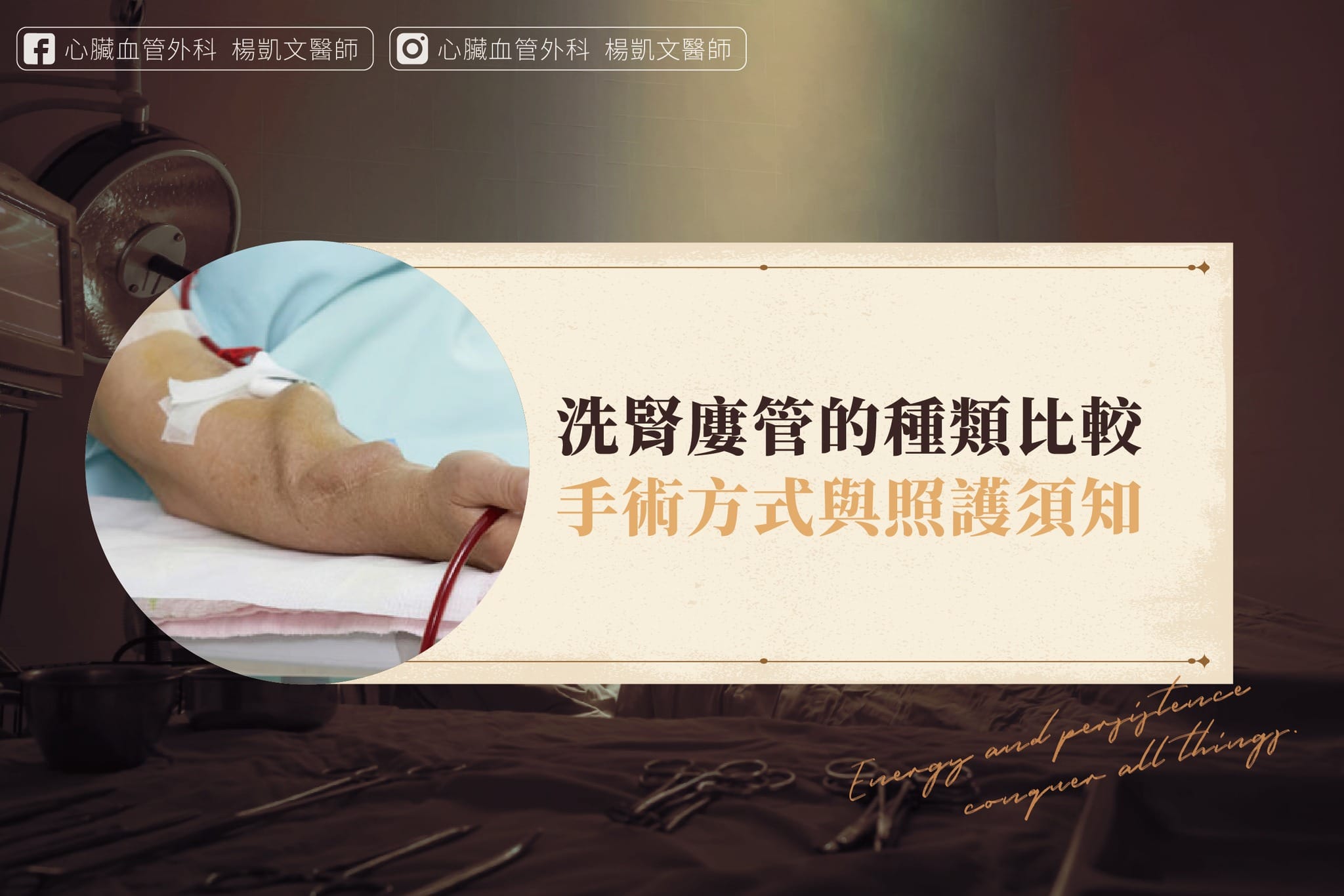 洗腎廔管的種類比較