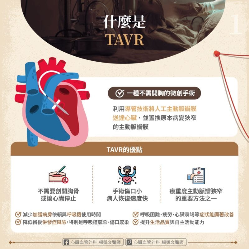 什麼是TAVR
