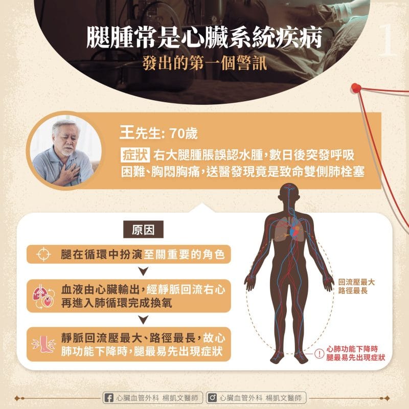 腿腫 心臟病