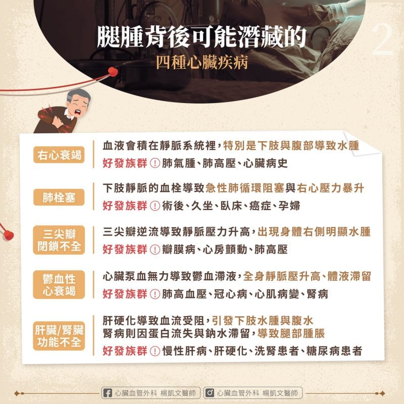 腿腫 潛在心臟疾病