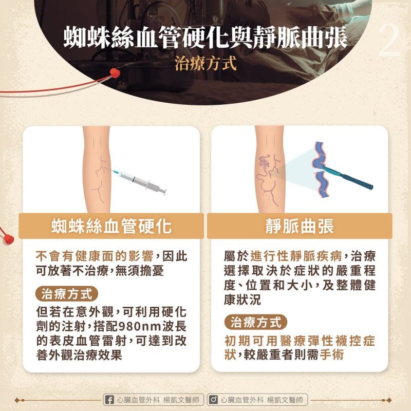 血管硬化 靜脈曲張 治療